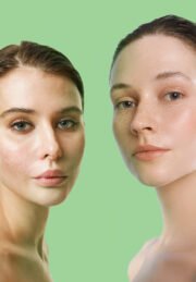 ⁦Derma Active ACTI-CLEAR Global AC Cream⁩ - الصورة ⁦2⁩